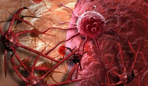 Read more about the article Alimente, ierburi și alte substanțe naturale care omoară cancerul – mai sigure și mai eficiente decât orice medicament